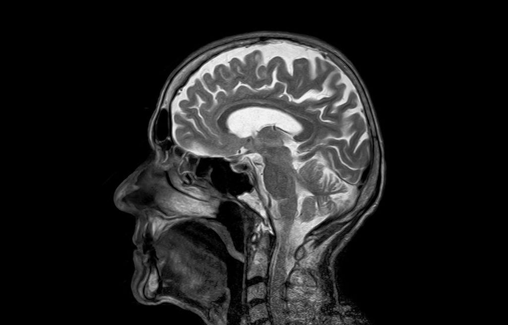 أعراض نوبة الهلع: ماذا يحدث في الجسم؟